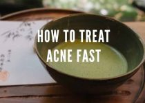 DISCOVER HOW TO CURE ACNE | how to treat acne overnight getting rid of acne