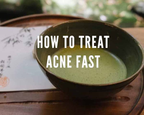 DISCOVER HOW TO CURE ACNE | how to treat acne overnight getting rid of acne