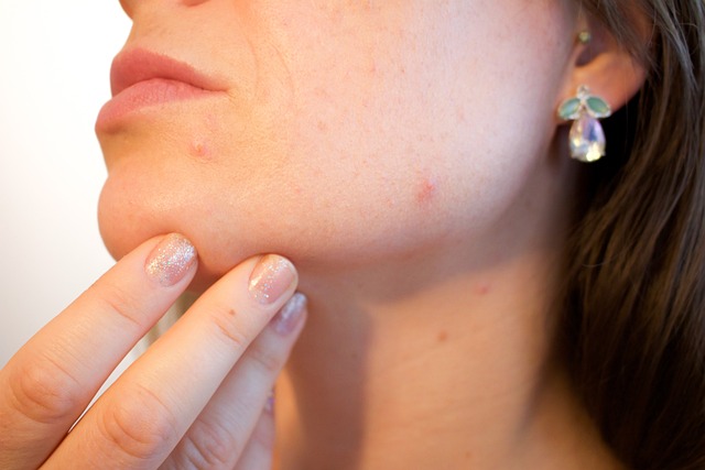 combat zits and blemishes with these ideas