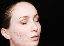 DISCOVER HOW TO CURE ACNE | check out these must read skin care tips