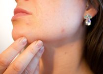 DISCOVER HOW TO CURE ACNE | eliminate pesky zits with these tips and pieces of advice