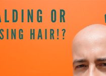 DISCOVER HOW TO CURE ACNE | how to stop balding and hair loss