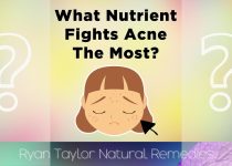 DISCOVER HOW TO CURE ACNE | rootF IMG 66d99734c3e96