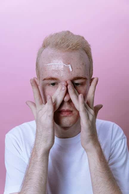 How to Cure Adult Acne: Tips for Clear Skin F IMG 68ab224636ee5